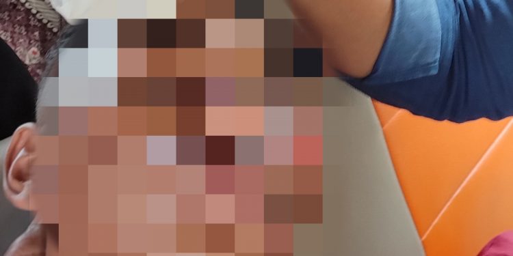 Rizky Eka Pratama mengalami luka cukup parah dan harus menjalani opname (Nanang Priyo Basuki)