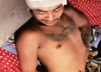 Usai ‘Jamu’ Bareng Berakhir Banjir Darah, Warga Bedali Dihujani Parang di Sumber Mantenan Wates