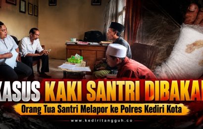 Miris! Kaki Santri 13 Tahun Diduga Dibakar Pakai Cairan Pewangi dan Korek Api di dalam Pondok